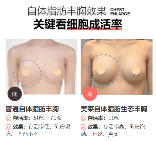 昆明和记AG平台怡情娱乐官网丰胸是怎么做的