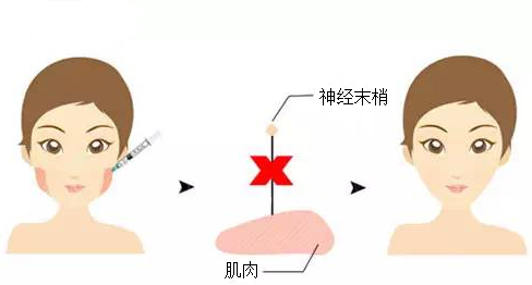 武汉和记AG平台怡情娱乐官网瘦脸需要注意事项有哪些