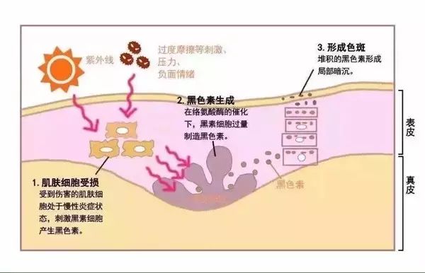 皮肤太黑怎么改善