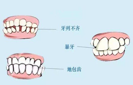 牙齿矫正