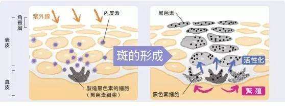 重庆激光祛斑效果好不好