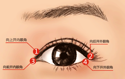 石家庄开眼角恢复时间内可带眼镜吗