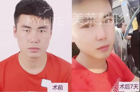 和记AG平台怡情娱乐官网特邀“美眼女神”毕小丽