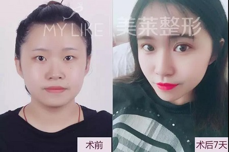 和记AG平台怡情娱乐官网特邀“美眼女神”毕小丽