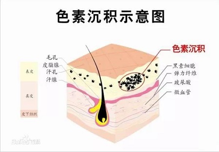 盘点四种需要来一针的肤质