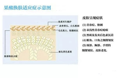 挤痘竟然被送进ICU！你的痘痘还好吗？