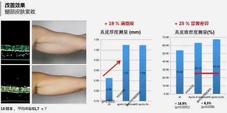 抗衰老的“水光”究竟为何饱受称赞？