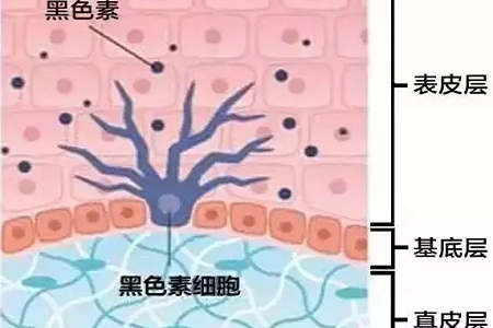 祛斑偏方“害死人”，小仙女们可长点心吧！