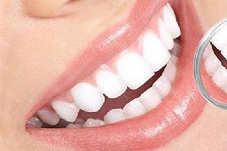 医美白皮书：你以为别人洁白整齐的牙齿都是天生吗？