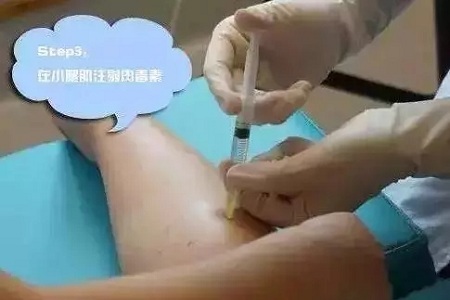 这有一个快速又持久瘦小腿的方法！请注意查收！