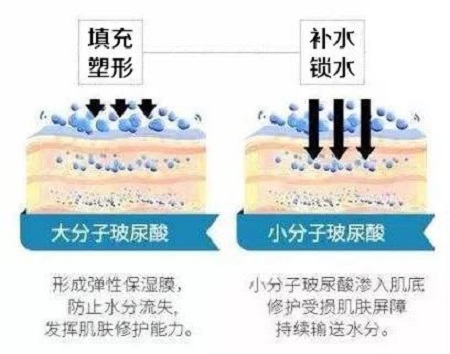 玻尿酸