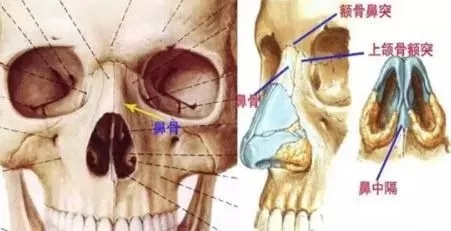 侧面看鼻梁不矮,正面看鼻子却很塌是什么原因？