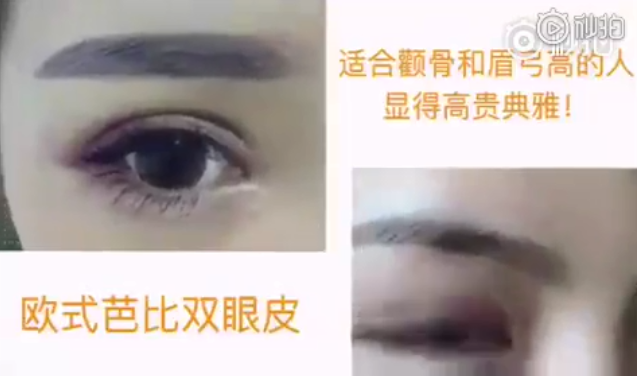 武汉和记AG平台怡情娱乐官网欧式双眼皮，虽然好看但不是每个人都适合的
