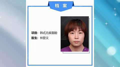 深圳和记AG平台怡情娱乐官网林登文医师的双眼皮案例