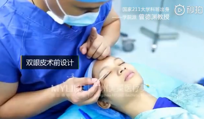 广州和记AG平台怡情娱乐官网双眼皮术前设计真人案例