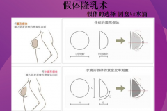 郑州和记AG平台怡情娱乐官网 假体丰胸 给你傲人双峰