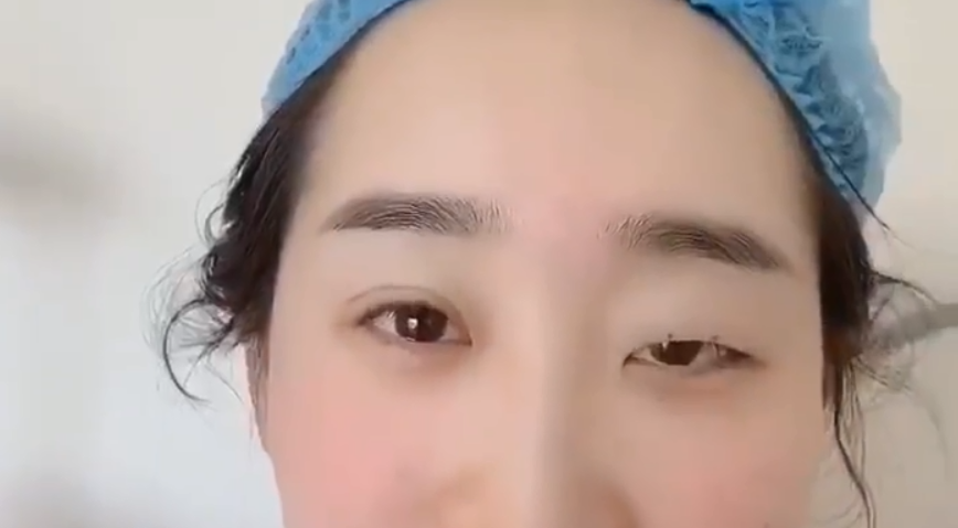 郑州和记AG平台怡情娱乐官网来围观双眼皮和单眼皮的区别