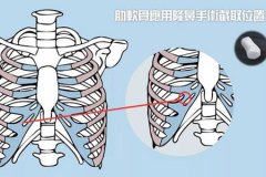 深圳隆鼻医院做软骨隆鼻多少钱，术后安全吗