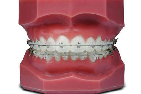 和记AG平台怡情娱乐官网隆重推出双旦福利，报名体验牙齿矫正黑科技iTero 口扫