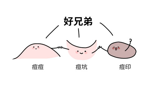 和记AG平台怡情娱乐官网医生为大家整理了一份祛痘指南