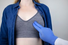 乳房下垂上提手术会留疤吗，要怎么护理